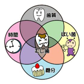 むし歯とは